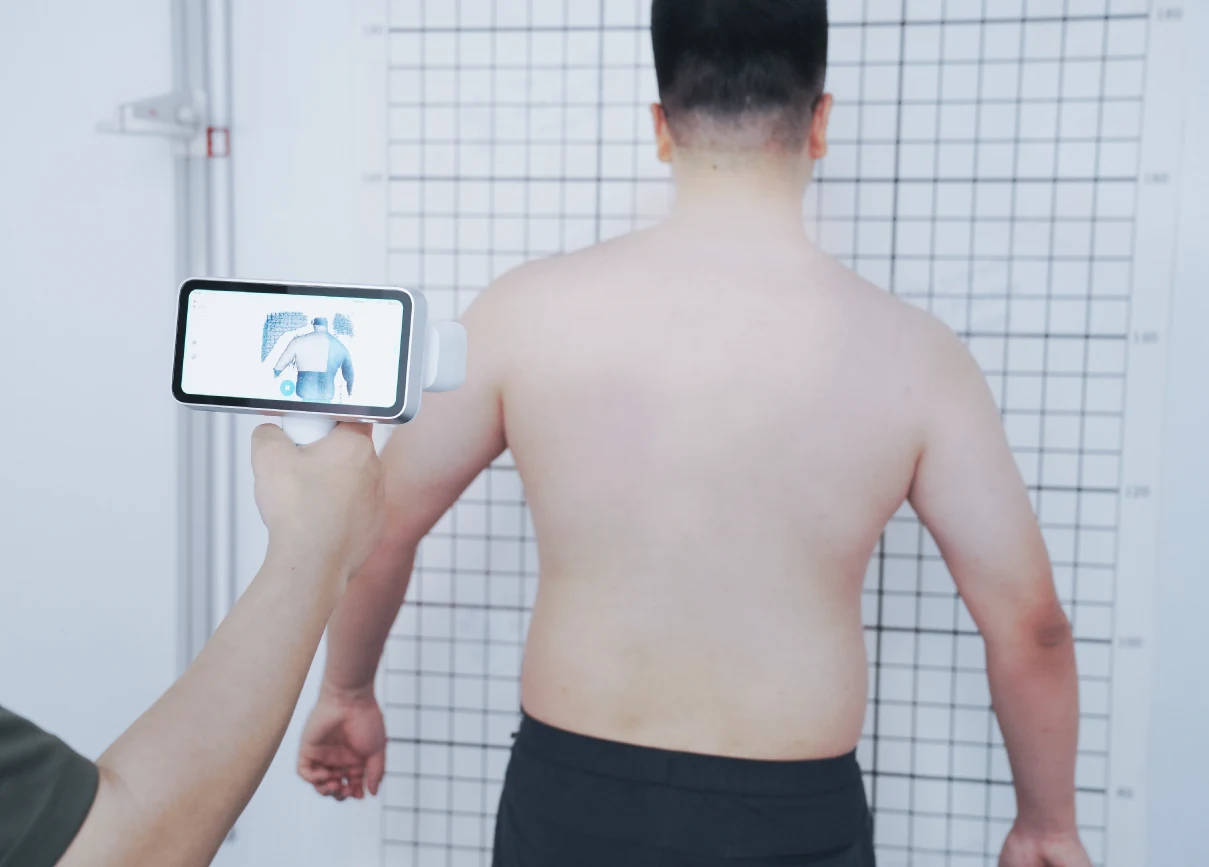 Escaneo de torso con EinScan Medixa y compensación de pequeños movimientos