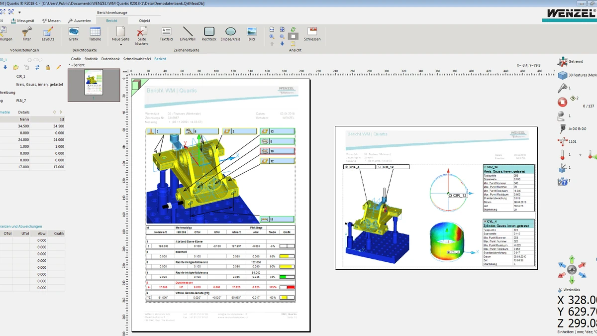 Evaluación dimensional y resultados sobre CAD en WM | Quartis